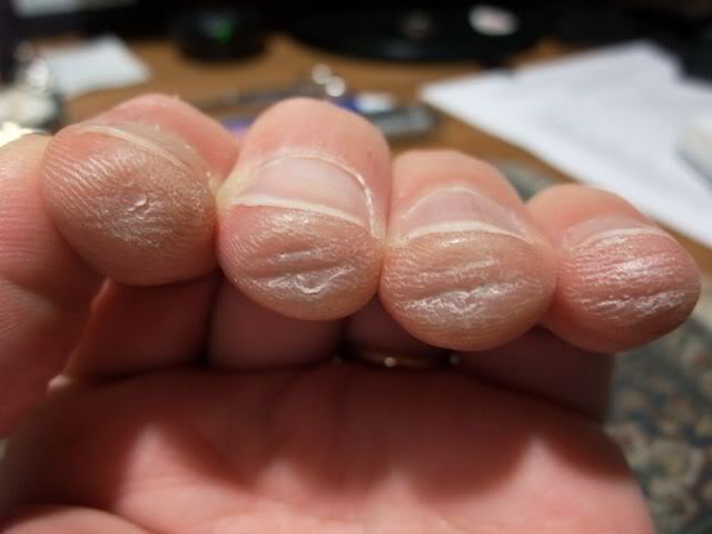Durerea degetelor la chitaristi incepatori